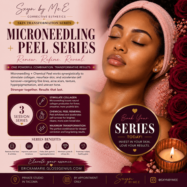 Microneedling + Peel 3 Series at SXYN by Me. E in Tacoma, WA